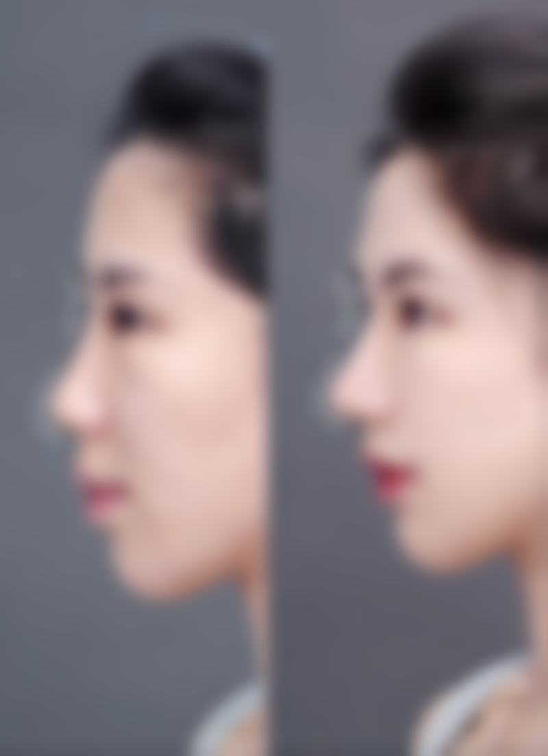 韓國世金整形醫院價格表2026中韓報價大公開！隱藏收費+項目對比必睇
