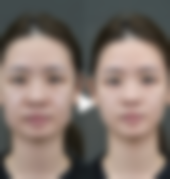 韓國banal整形外科醫院怎麼預約掛號：適合邊類人群？