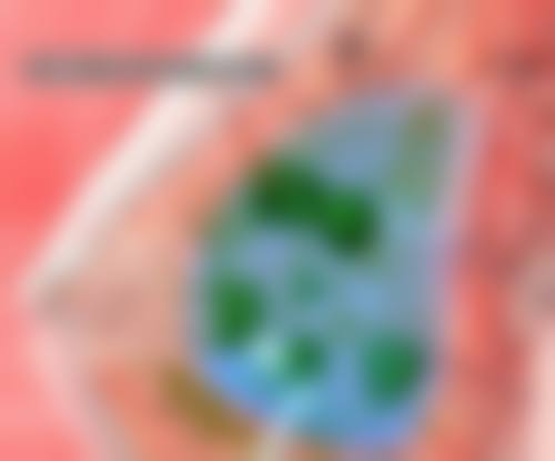 临床实例分享