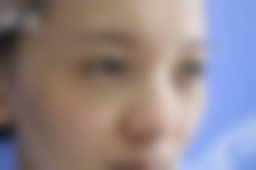 韓國肋骨鼻恢復期多久 適合邊類人群?港澳姊妹對號入座