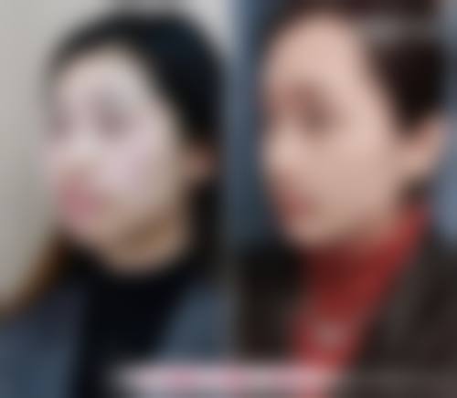 惠州博罗新艺口腔地理位置便于到院。