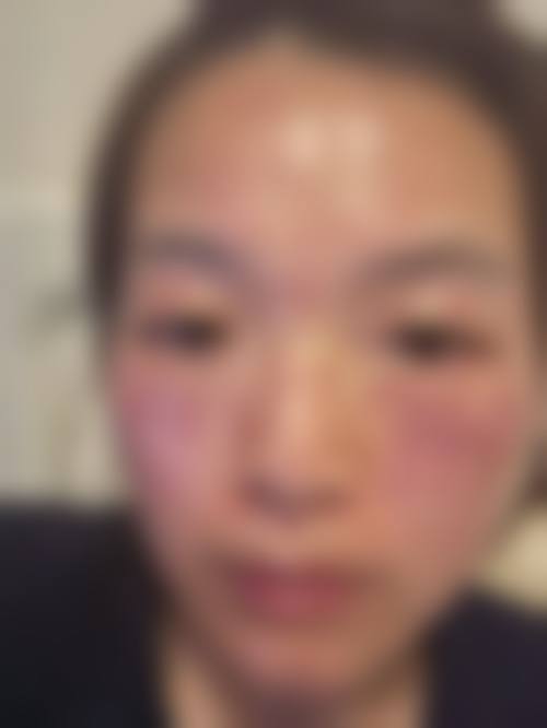 三、李绿水医生技术水平高: