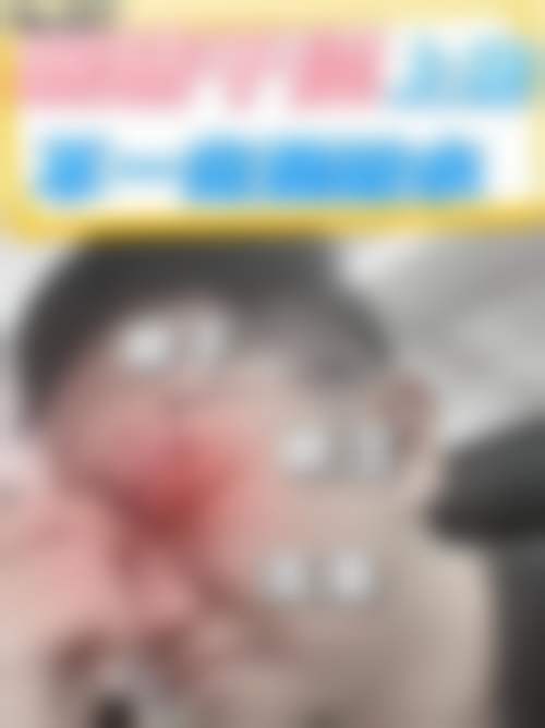 杭州明镜眼科医院特色技术及优质服务