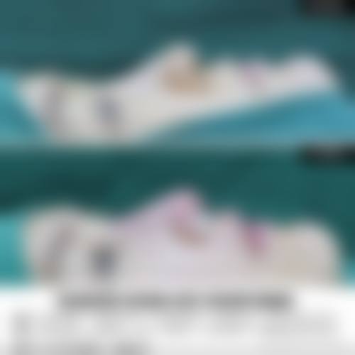 韓國肋骨鼻恢復期多久？2026真實案例180天恢復全過程+嗅覺何時返嚟？