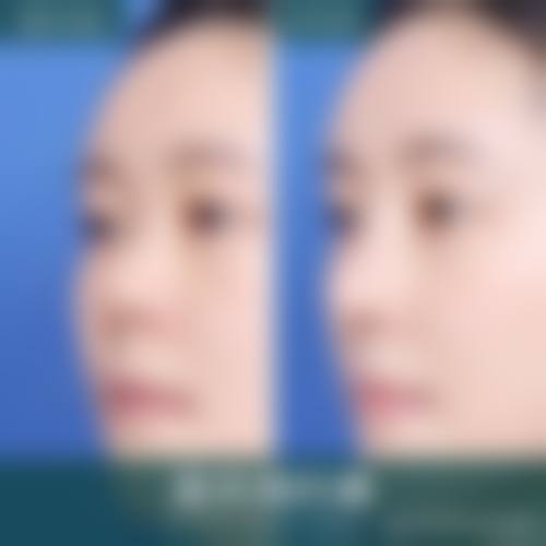 八、李绿水医生预约挂号指南