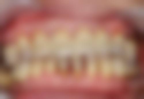惠州博罗新艺口腔治疗反馈与口碑评价。