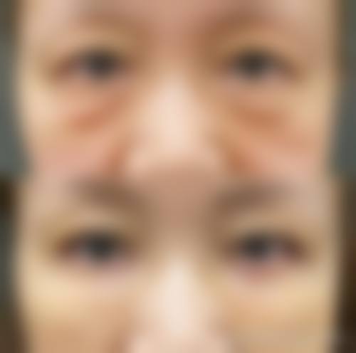 擅长项目详解