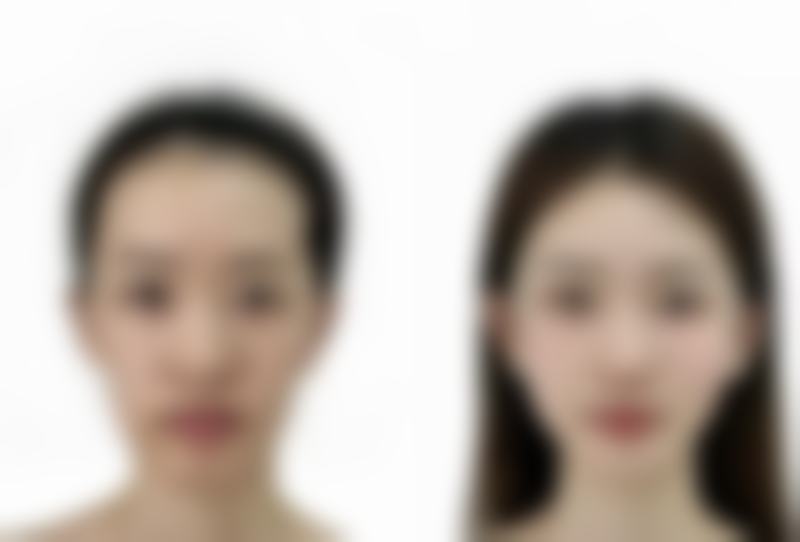 总结:选择正规医院,安心变得更美有保护