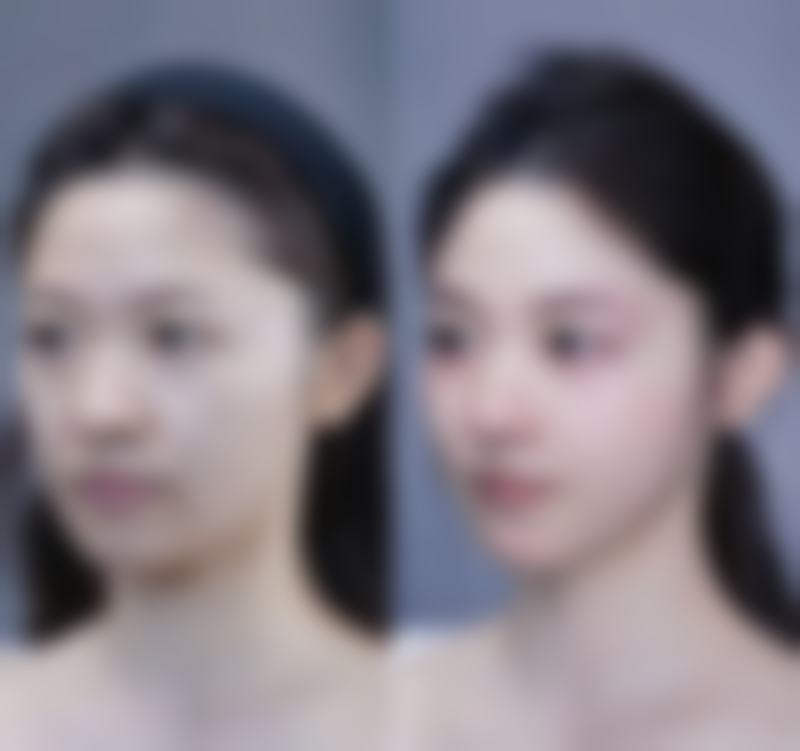 重庆宝拉(众晶)医疗美容门诊部擅长项目。